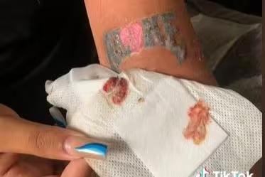 Suraya Khan mostra como o braço ficou após uma tatuagem malfeita (Foto: TikTok/Reprodução)