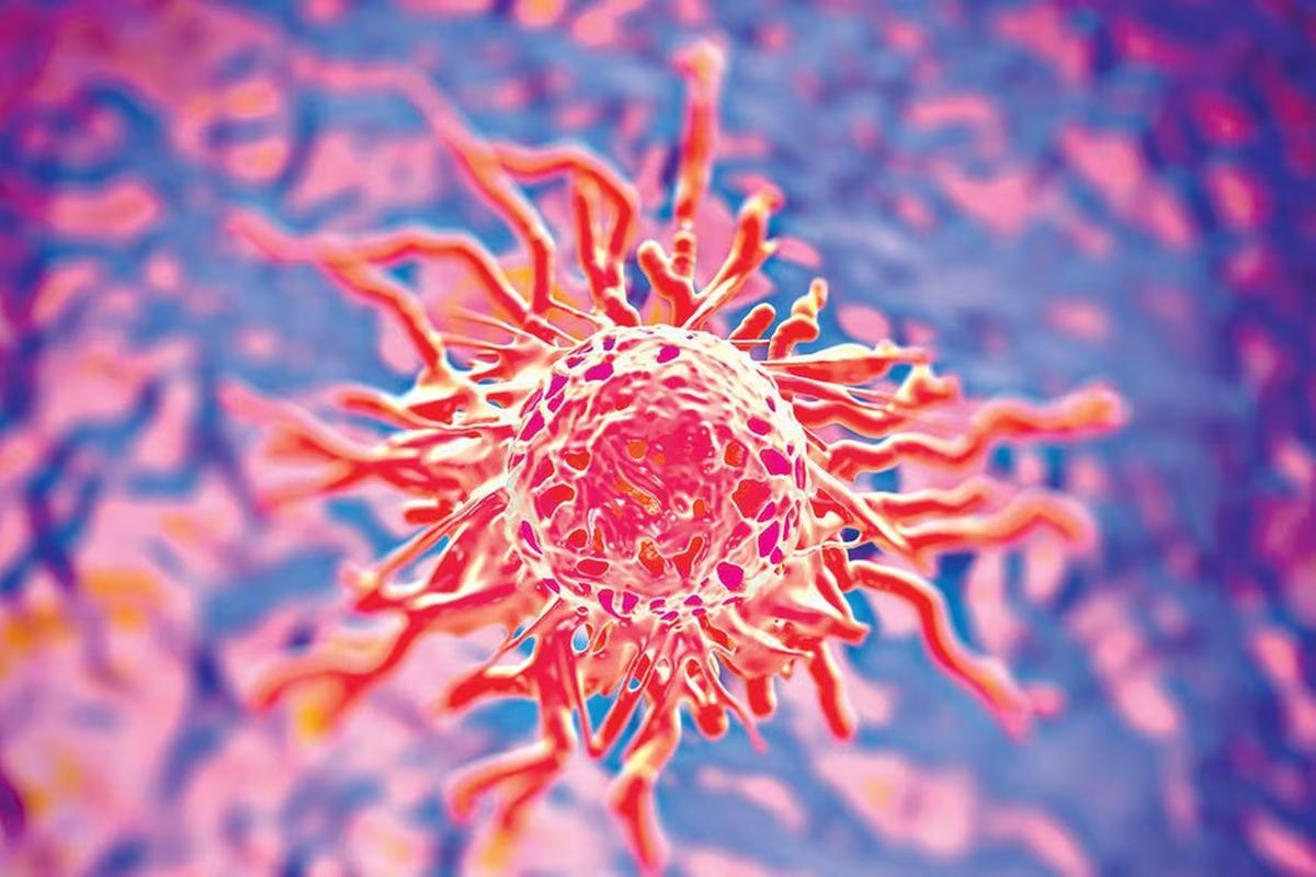 O câncer é o crescimento anormal e desordenado de células e pode ocorrer em qualquer parte do corpo humano (Foto/Jonclive/Reprodução)