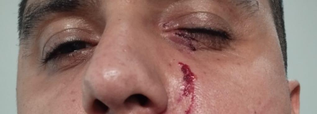 Agente socioeducativo foi agredido a unhadas por uma mãe inconformada com o fato de que seu filho continuaria internado (Foto/Divulgação)