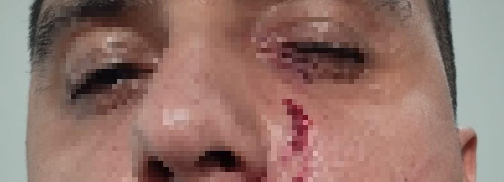 Com as unhas, a mulher feriu o rosto e pescoço do agente socioeducativo do Cseur (foto/Divulgação)