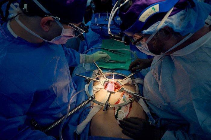 Transplante de rim de porco foi feito em março, em um homem de 62 anos (Foto/Joe Carrota/NYU Langone Health/AFP)