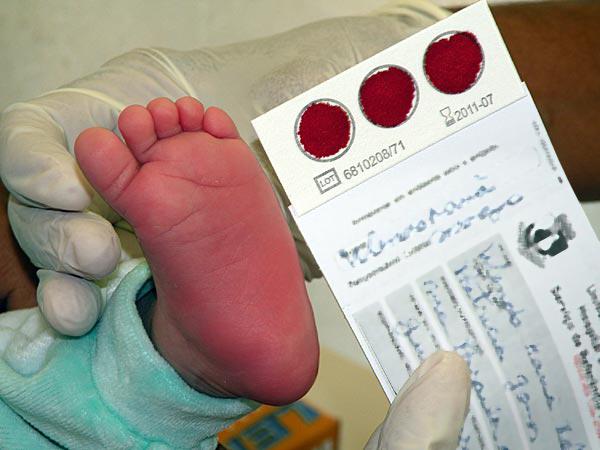 Teste pode identificar até 15 doenças em recém-nascidos (Foto/Reprodução)