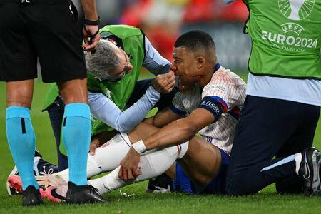 A lesão no nariz de Mbappé é considerada grave (Foto/Ozan Kose/AFP)