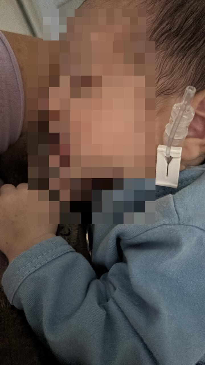 Bebê teria precisado de cirurgia para remover agulha que quebrou em seu pescoço (Foto/Divulgação)