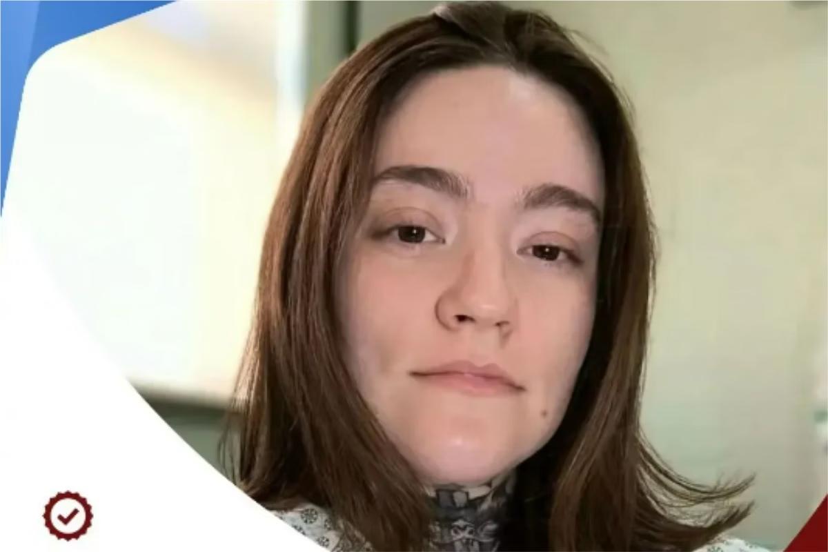 Carolina Arruda vive há 11 anos com neuralgia do trigêmeo (Foto/Reprodução / @sbed_brasil / Instagram)