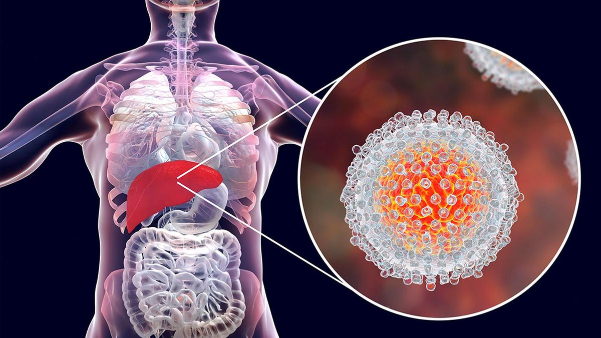 Dados do Departamento de Vigilância Epidemiológica, em 2025 já foram registrados 19 casos de hepatites A, B, C e D no município. Em 2024, foram 83 notificações. (Foto/Ilustrativa)