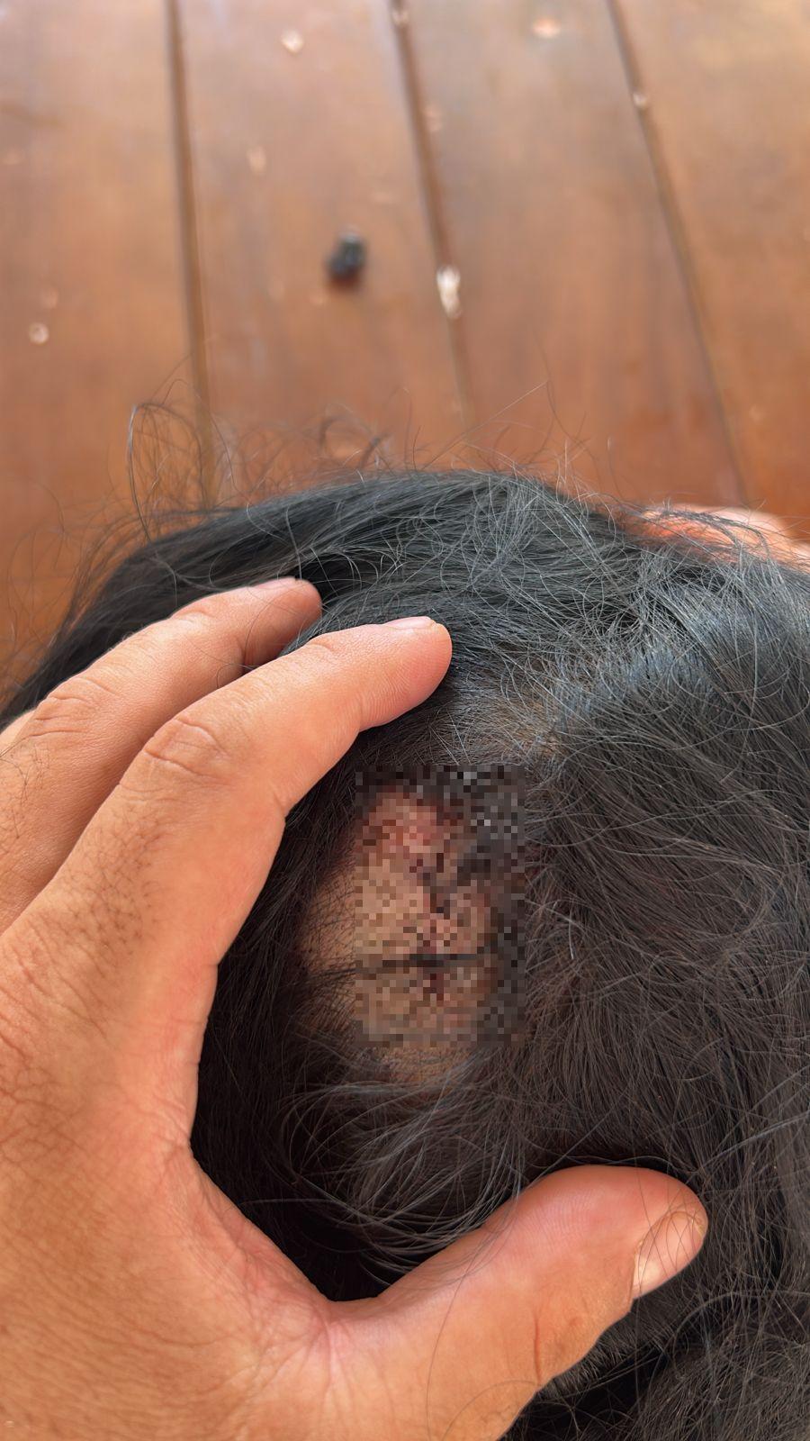 Agressões teriam resultado em diversos ferimentos (Foto/Divulgação GCM)