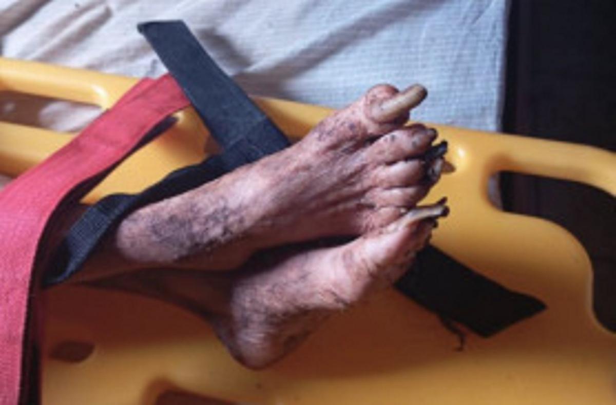 Bastante debilitada, a idosa foi resgatada pelo Samu (Foto/Equipe Positiva/Divulgação)