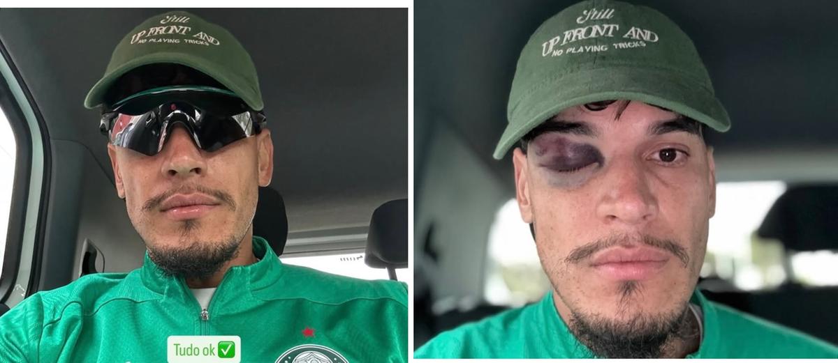 Capitão do Verdão sofre pancada contra o River, mas exames descartam lesão grave (Foto/Instagram do Jogador)