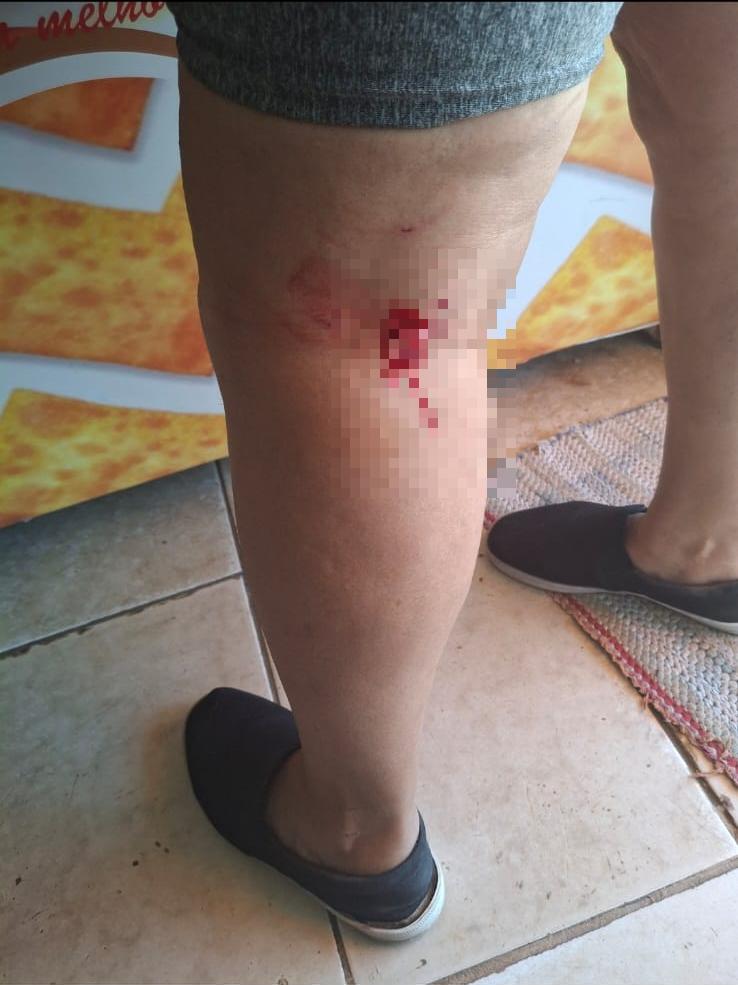 Mulher teria ficado ferida após ataque do animal (Foto/Divulgação)