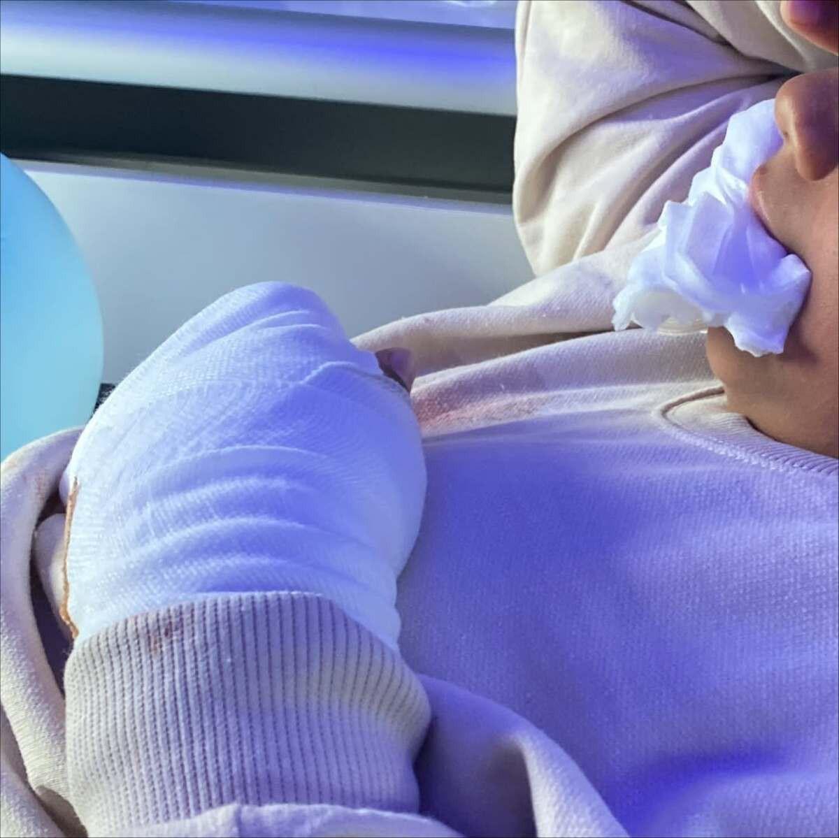 Um estudante brasileiro de 9 anos teve dois dedos decepados em uma escola em Cinfães, no centro de Portugal (Foto/Reprodução/Instagram)