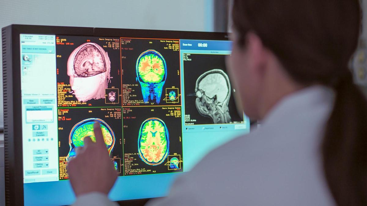 Pesquisadores identificaram cinco fases distintas no desenvolvimento do cérebro (Foto/Monty Rakusen/Getty Images)