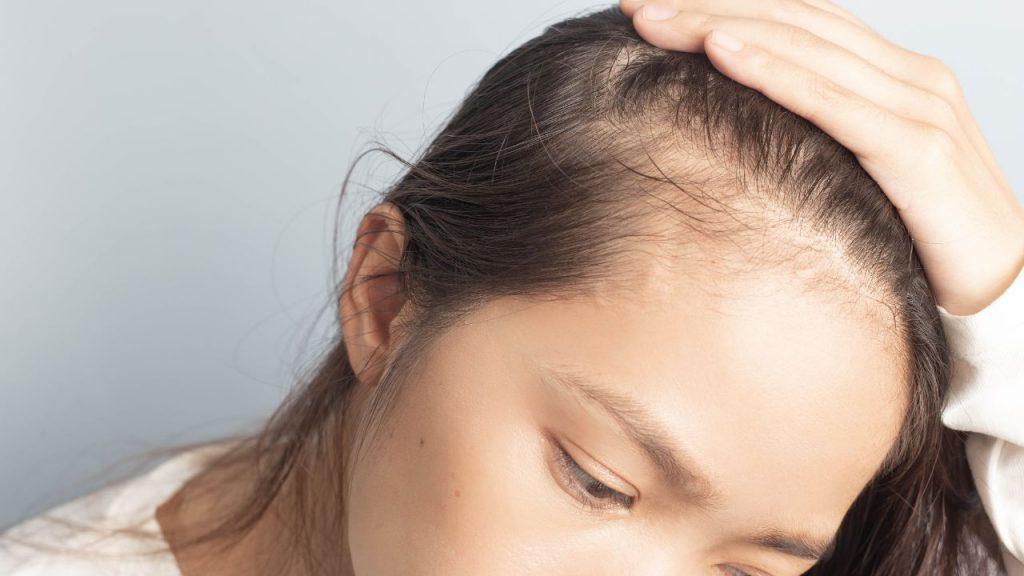 A tricologista reforça que o tempo é decisivo para o sucesso do tratamento (Foto/Reprodução)