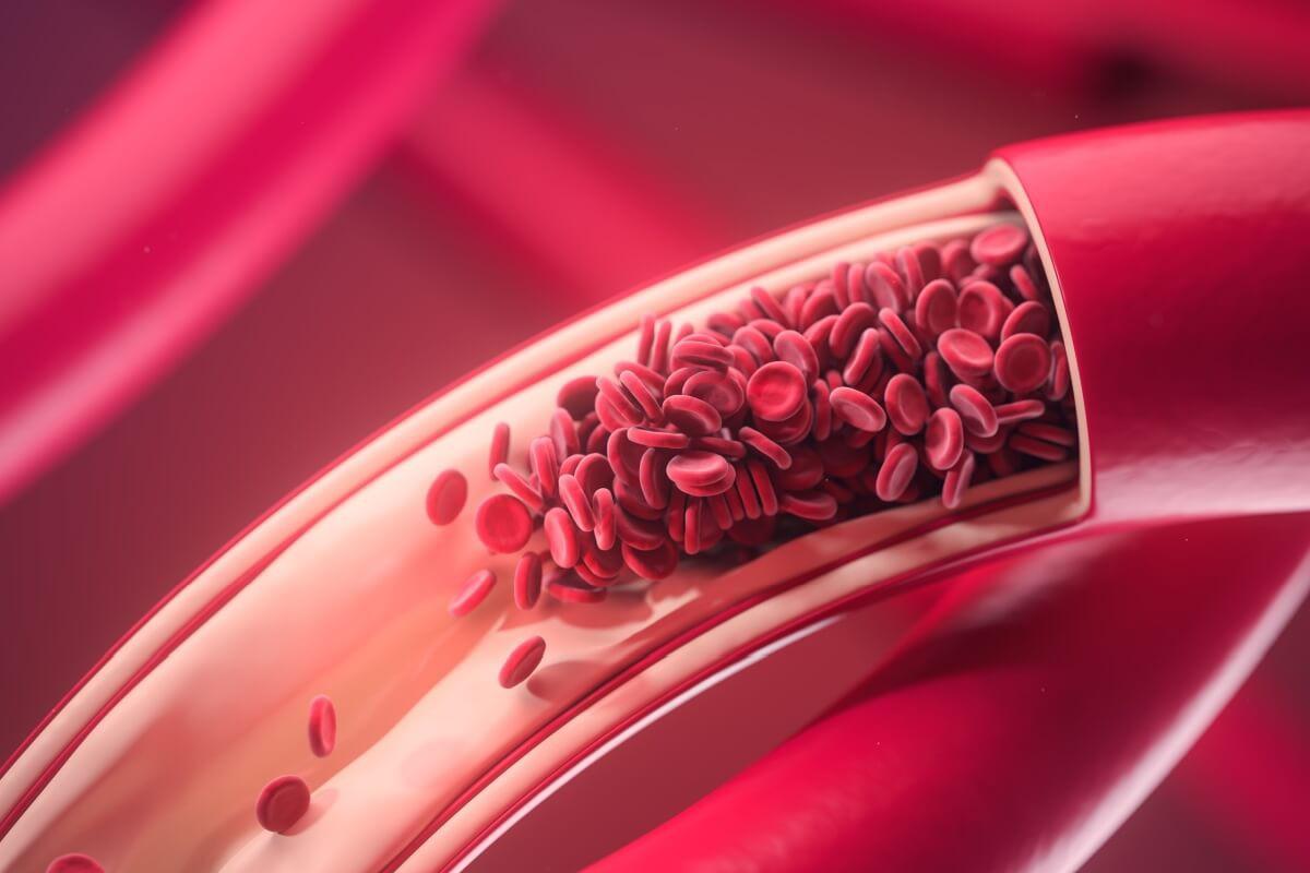 A combinação de calor e imobilidade prolongada eleva o risco de trombose (Foto/KateStudio/Shutterstock)