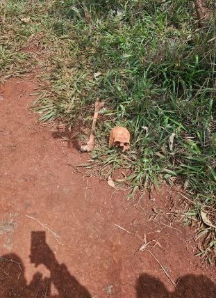 Os trabalhadores encontraram um crânio humano e outro osso fêmur, indicando que os restos mortais estavam espalhados pela área