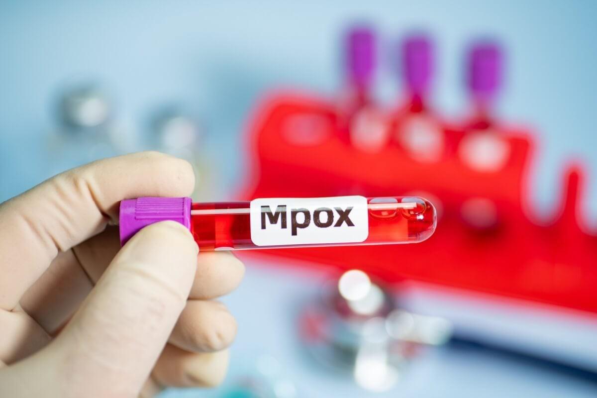 A mpox é uma doença viral transmitida por contato direto com lesões ou superfícies contaminadas (Foto/QINQIE99/Shutterstock)