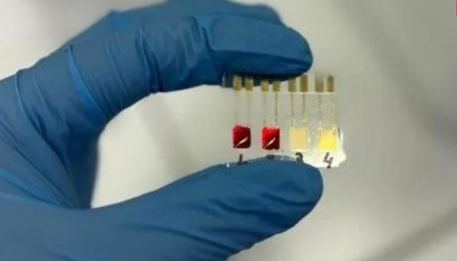 Sensor eletroquímico criado por pesquisadores da USP detecta câncer no pâncreas ainda nos estágios iniciais (Foto/Gabriella Soares)