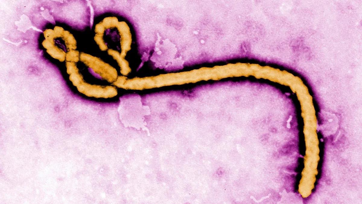 Vírus do Ebola (Frederick Murphy/CDC/AP via CNN Newsource)