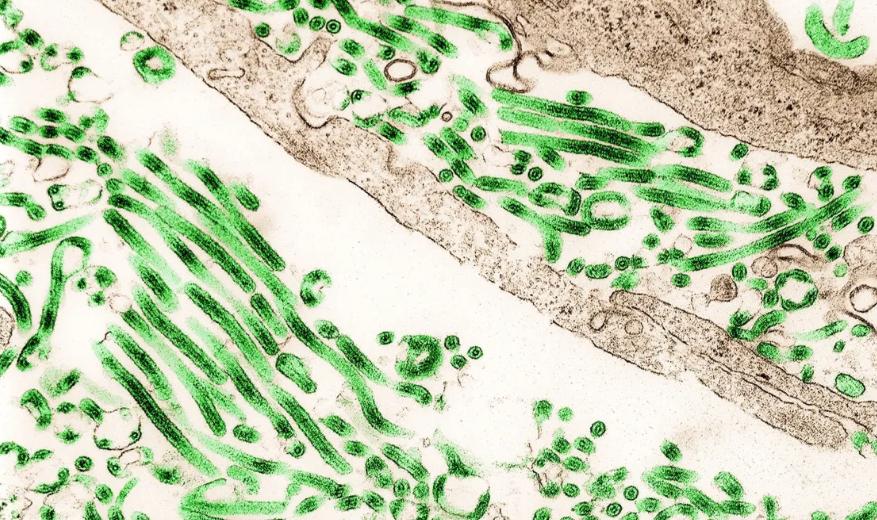 Vírus do Ebola visto no microscópio (Foto/Reprodução)